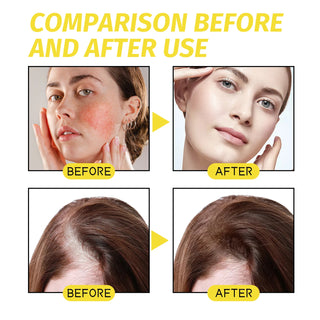Hair growth essential oil. Effectively repair baldness and hair loss symptoms